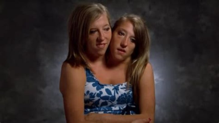 Abby And Brittany Hensel Family Tragedy: A Journey Through Struggles And Resilience