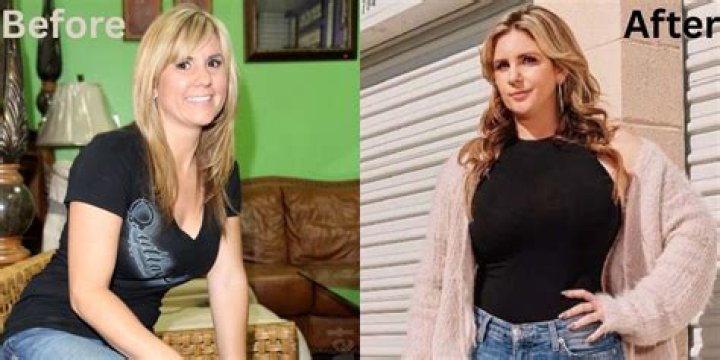 Brandi Passante Plastic Surgery Photos [Before & After] Surgery4