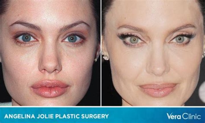 Connor, Angelina Jolie Lips, Andi Mack, Alice Book, Casting Kit, The