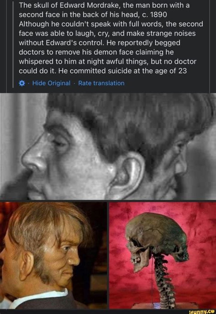 Edward Mordrake From American Horror Story Is Unrecognizable In Real Life