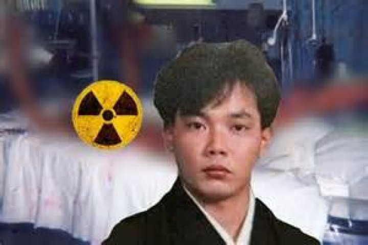 Hisashi Radiation Photos A Deep Dive Into The Impact Of Radiation Exposure