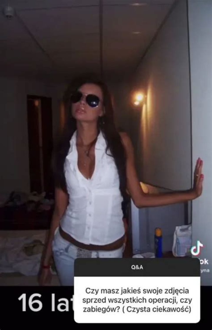 Justyna Gradek poprawiła mężowi twarz! Kozaczek