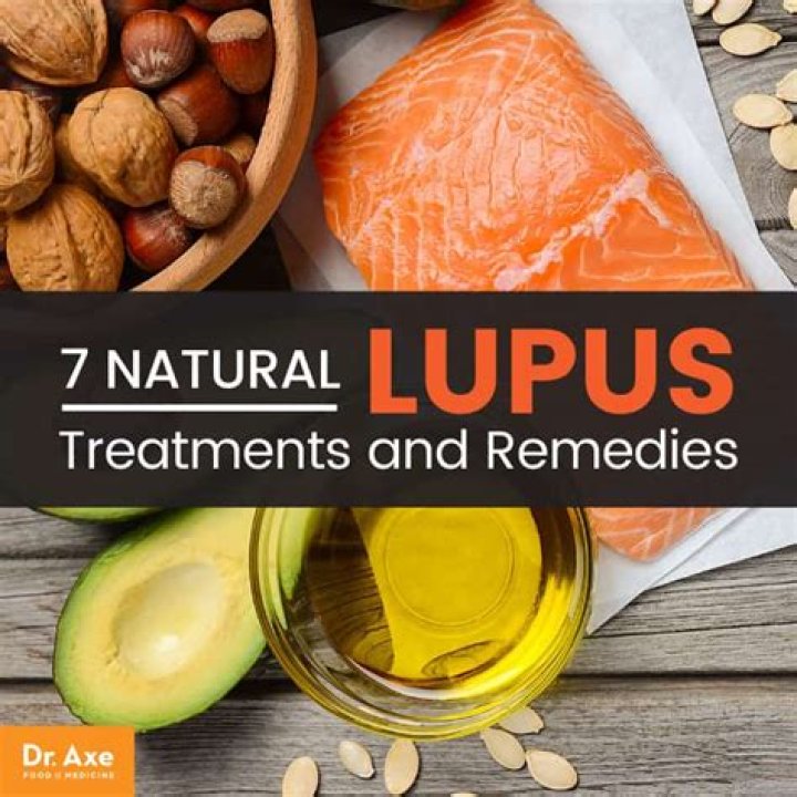 Lupus Natural Treatments and Remedies Dr. Axe