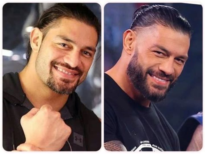 Randy Orton Compares Roman Reigns' New Teeth to a Farm Animal in Hilarious Post