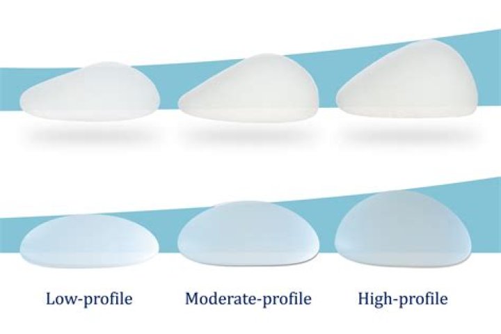 Sha'Carri Breast Implants: The Journey Of Transformation And Empowerment