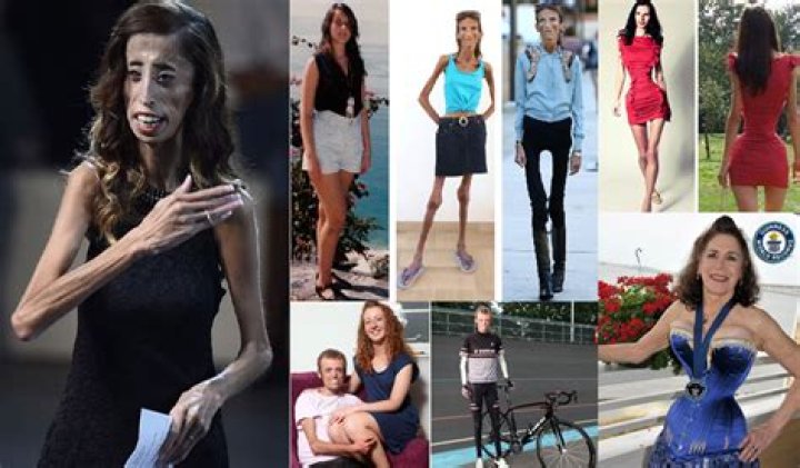 Skinniest Person Meet 10 World's Thinnest People Alive 2024 The