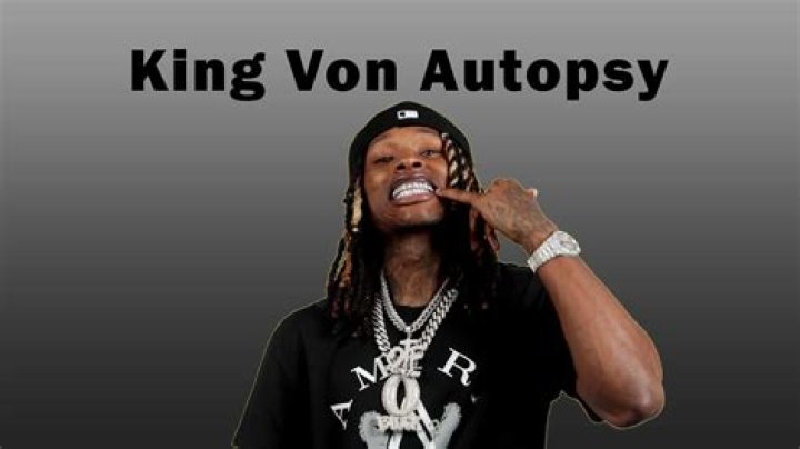 Understanding The Controversy Surrounding King Von's Autopsy Picture