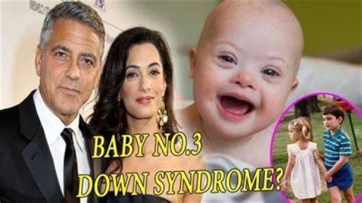 Unraveling The Truth Does Clooney's Child Have Down Syndrome?