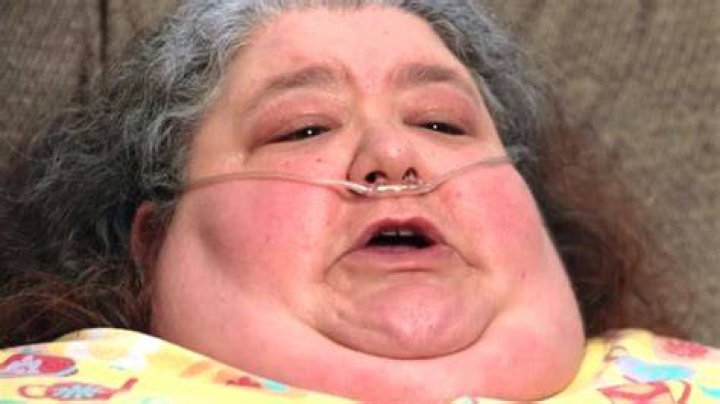 Where Is Joyce Del Viscovo From My 600-Lb Life Now?