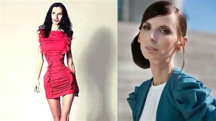 Who is the Skinniest Person in the World? It's a real shock